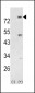 PI3KR5 Antibody (Center)